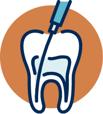 ROOT CANALS